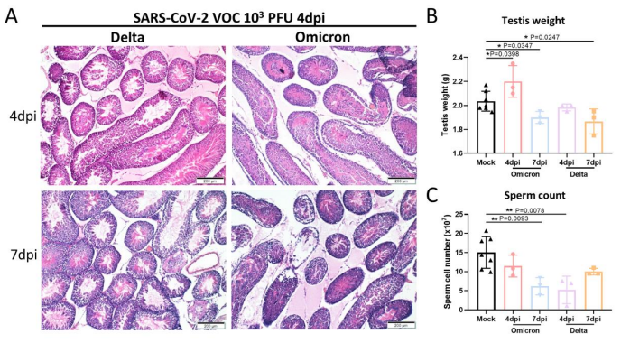 实锤了!香港院士团队发现，奥密克戎引起睾丸急性损伤和萎缩w5.jpg