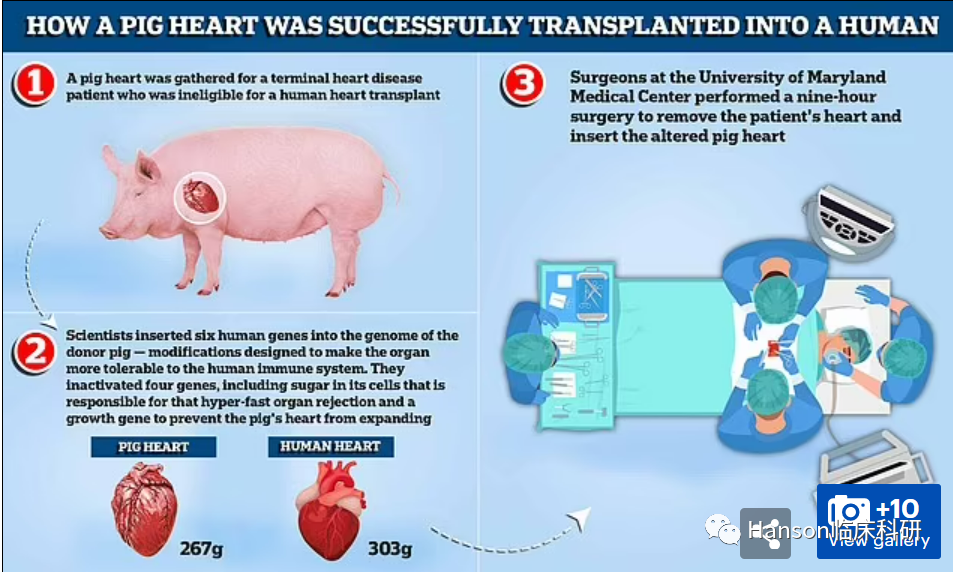 全球首例移植猪心脏的患者死亡，家属竟然这么说w2.jpg