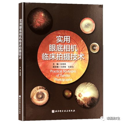 《中国干眼专家共识:生活方式相关性干眼(2022 年)》重磅发布!w52.jpg