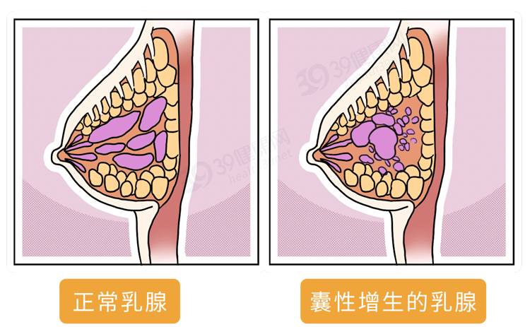 29岁就开始尿不尽，年轻人的前列腺怎么了?w10.jpg